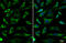 Succinate Dehydrogenase Complex Flavoprotein Subunit A antibody, GTX636335, GeneTex, Immunofluorescence image 