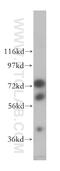 DEAD-Box Helicase 43 antibody, 17591-1-AP, Proteintech Group, Western Blot image 