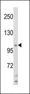 Helicase Like Transcription Factor antibody, 62-482, ProSci, Western Blot image 