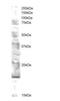 Ubiquitin Conjugating Enzyme E2 V2 antibody, orb18381, Biorbyt, Western Blot image 