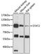 Signal Transducer And Activator Of Transcription 2 antibody, LS-C749975, Lifespan Biosciences, Western Blot image 