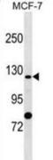 Anion exchange protein 4 antibody, abx029853, Abbexa, Western Blot image 