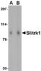 SLIT And NTRK Like Family Member 1 antibody, TA306522, Origene, Western Blot image 