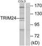 Tripartite Motif Containing 24 antibody, TA314810, Origene, Western Blot image 