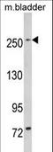 Leucine Rich Repeat Kinase 1 antibody, LS-C98062, Lifespan Biosciences, Western Blot image 