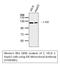 Insulin Degrading Enzyme antibody, STJ96985, St John