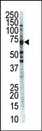 Cyclin Dependent Kinase 8 antibody, AP14153PU-N, Origene, Western Blot image 