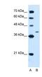 Protein Tyrosine Phosphatase Non-Receptor Type 2 antibody, NBP1-60093, Novus Biologicals, Western Blot image 