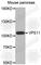 VPS11 Core Subunit Of CORVET And HOPS Complexes antibody, A3462, ABclonal Technology, Western Blot image 