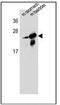 RAB25, Member RAS Oncogene Family antibody, AP53540PU-N, Origene, Western Blot image 