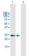 Lysophospholipase 2 antibody, H00011313-B01P, Novus Biologicals, Western Blot image 