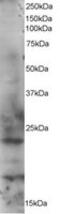 RAB2A, Member RAS Oncogene Family antibody, MBS420138, MyBioSource, Western Blot image 