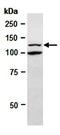 SWI/SNF Related, Matrix Associated, Actin Dependent Regulator Of Chromatin, Subfamily A, Member 5 antibody, orb67068, Biorbyt, Western Blot image 