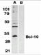 BCL10 Immune Signaling Adaptor antibody, 2161, ProSci, Western Blot image 