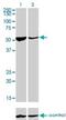 Aspartyl-TRNA Synthetase antibody, H00001615-M01, Novus Biologicals, Western Blot image 