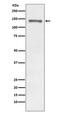 Regulatory Associated Protein Of MTOR Complex 1 antibody, M01463, Boster Biological Technology, Western Blot image 