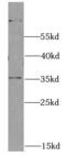 SCO Cytochrome C Oxidase Assembly Protein 1 antibody, FNab07650, FineTest, Western Blot image 