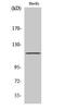 ST18 C2H2C-Type Zinc Finger Transcription Factor antibody, A10267-1, Boster Biological Technology, Western Blot image 