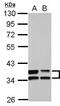 Annexin A3 antibody, GTX103330, GeneTex, Western Blot image 