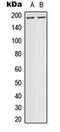 DCC Netrin 1 Receptor antibody, orb216085, Biorbyt, Western Blot image 