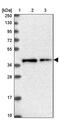 Transmembrane Protein 164 antibody, PA5-58540, Invitrogen Antibodies, Western Blot image 