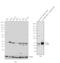 TIMP Metallopeptidase Inhibitor 2 antibody, MS608PABX, Invitrogen Antibodies, Western Blot image 