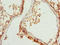 RAB31, Member RAS Oncogene Family antibody, orb40509, Biorbyt, Immunohistochemistry paraffin image 