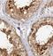 DnaJ Heat Shock Protein Family (Hsp40) Member A1 antibody, NBP1-88019, Novus Biologicals, Immunohistochemistry paraffin image 