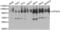 Sarcoplasmic/endoplasmic reticulum calcium ATPase 2 antibody, abx001018, Abbexa, Western Blot image 