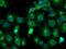 Tubulin Alpha Like 3 antibody, MA5-25772, Invitrogen Antibodies, Immunocytochemistry image 