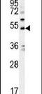 Potassium Voltage-Gated Channel Subfamily J Member 6 antibody, PA5-25747, Invitrogen Antibodies, Western Blot image 