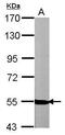 Neuregulin 1 antibody, GTX101117, GeneTex, Western Blot image 