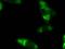 Polyubiquitin-B antibody, BML-PW1235-0025, Enzo Life Sciences, Immunofluorescence image 