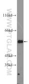 Glucose-6-Phosphate Dehydrogenase antibody, 25413-1-AP, Proteintech Group, Western Blot image 