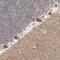 Chromosome 17 Open Reading Frame 53 antibody, PA5-54788, Invitrogen Antibodies, Immunohistochemistry paraffin image 