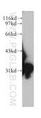 Sulfotransferase Family 1E Member 1 antibody, 12522-1-AP, Proteintech Group, Western Blot image 