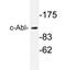 ABL Proto-Oncogene 1, Non-Receptor Tyrosine Kinase antibody, AP20696PU-N, Origene, Western Blot image 