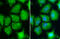 Ribosomal Protein S6 antibody, GTX113542, GeneTex, Immunofluorescence image 
