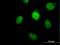 DNA Polymerase Beta antibody, H00005423-B01P, Novus Biologicals, Immunocytochemistry image 
