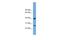 Triggering Receptor Expressed On Myeloid Cells Like 2 antibody, A08894, Boster Biological Technology, Western Blot image 