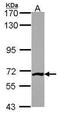 Phosphoacetylglucosamine mutase antibody, PA5-22353, Invitrogen Antibodies, Western Blot image 