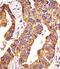 Matrix Metallopeptidase 14 antibody, A00656, Boster Biological Technology, Immunohistochemistry paraffin image 