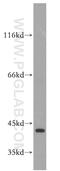 Capping Actin Protein, Gelsolin Like antibody, 19535-1-AP, Proteintech Group, Western Blot image 