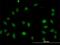 Ceramide Synthase 4 antibody, H00079603-M03, Novus Biologicals, Immunofluorescence image 