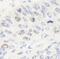 TOP2A antibody, NB110-40636, Novus Biologicals, Immunohistochemistry frozen image 