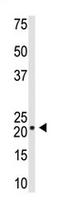 Visinin Like 1 antibody, AP11591PU-N, Origene, Western Blot image 