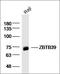 Zinc Finger And BTB Domain Containing 39 antibody, orb158754, Biorbyt, Western Blot image 