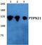Protein Tyrosine Phosphatase Non-Receptor Type 21 antibody, PA5-75804, Invitrogen Antibodies, Western Blot image 