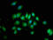 Protein Tyrosine Phosphatase Non-Receptor Type 3 antibody, LS-C671033, Lifespan Biosciences, Immunofluorescence image 