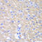 Glycerol-3-Phosphate Acyltransferase, Mitochondrial antibody, LS-C334827, Lifespan Biosciences, Immunohistochemistry frozen image 